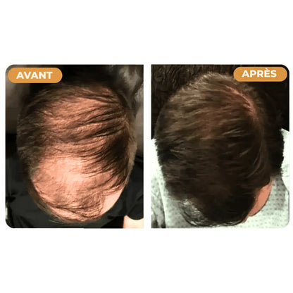 Hairzen Hair Root Shampoo