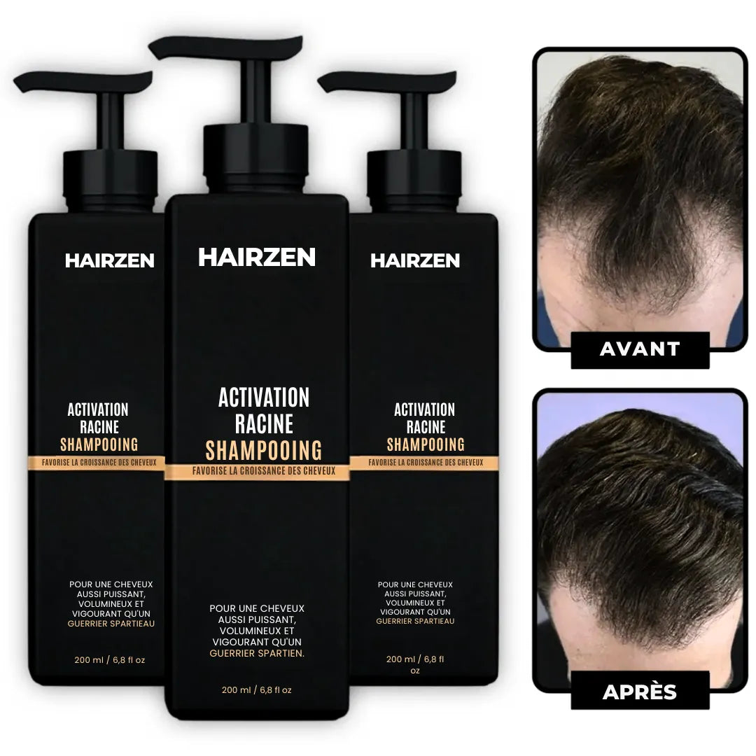Hairzen Hair Root Shampoo