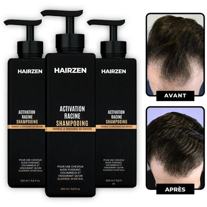Hairzen Hair Root Shampoo