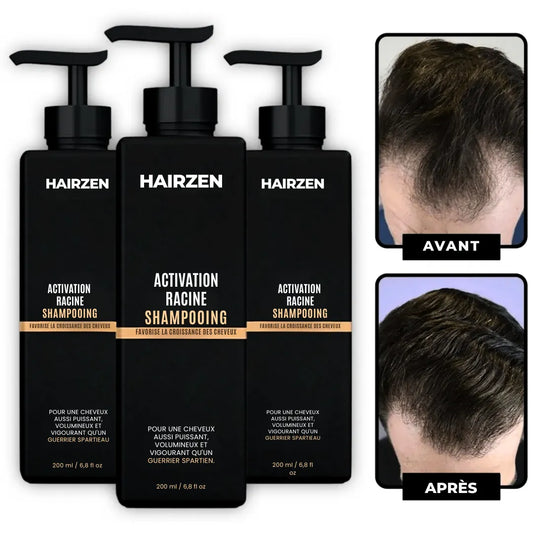 Hairzen Hair Root Shampoo